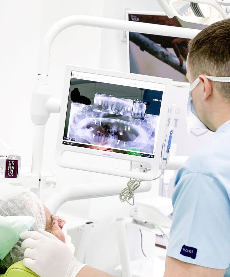 Radiografii dentare - Cum se realizează și care sunt principalele tipuri