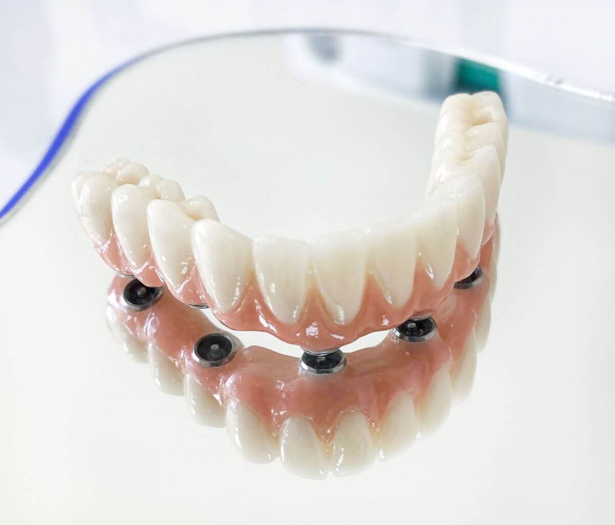 Sfaturi pentru periajul lucrărilor dentare