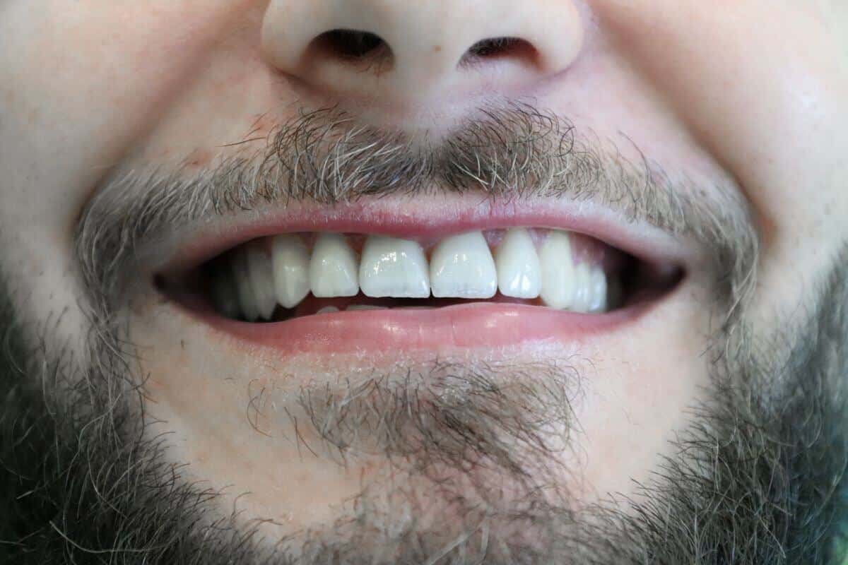 Smalţul dinţilor - care este rolul acestuia